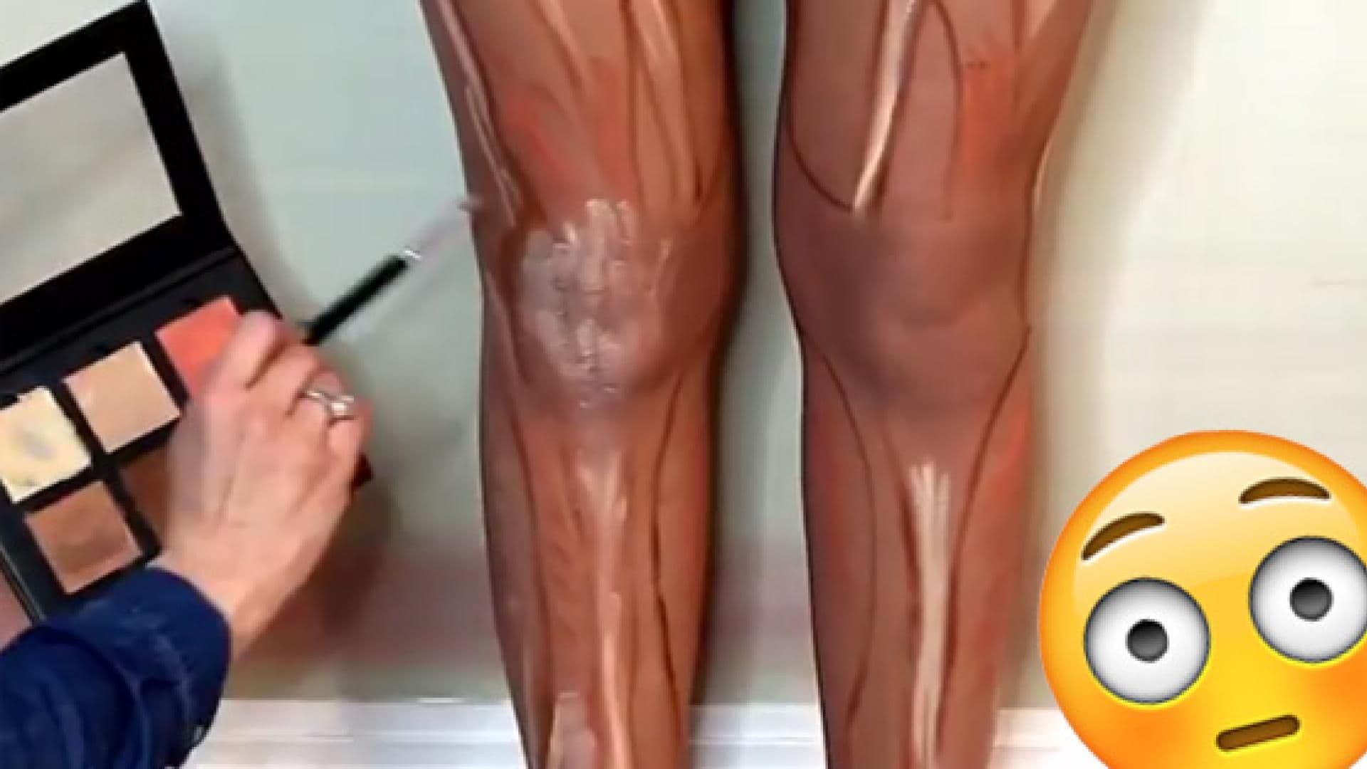 leg-contouring-557-2104682.jpg