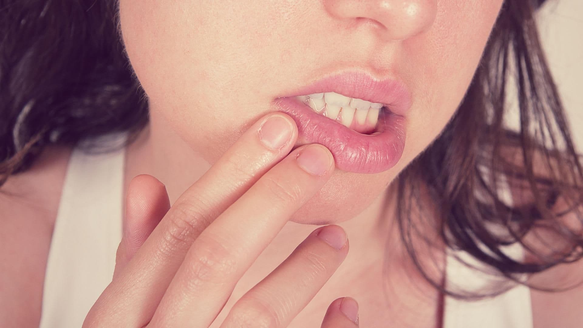 tipps-tricks-bei-lippenherpes-Quer