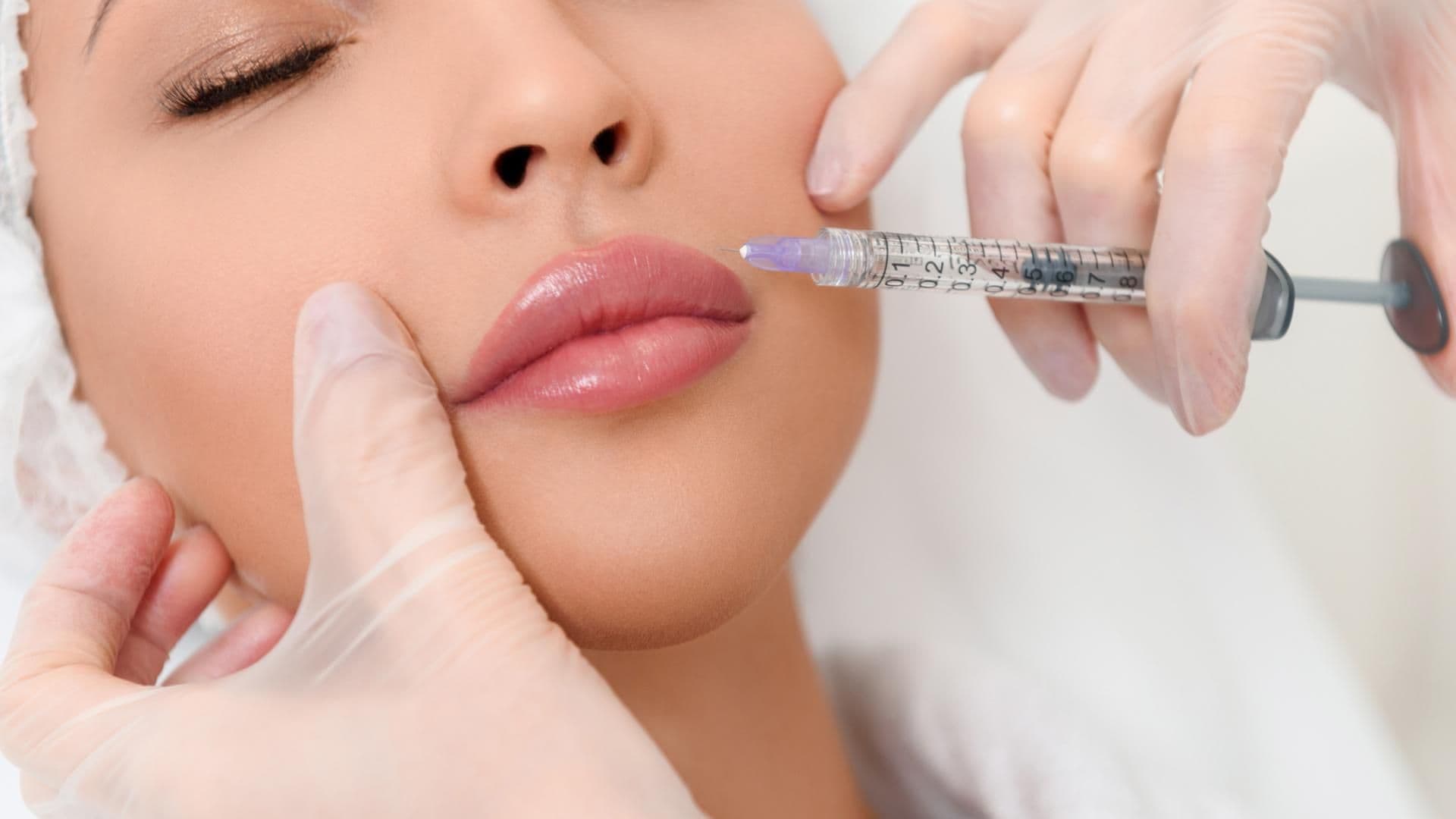 Lippen aufspritzen quer
