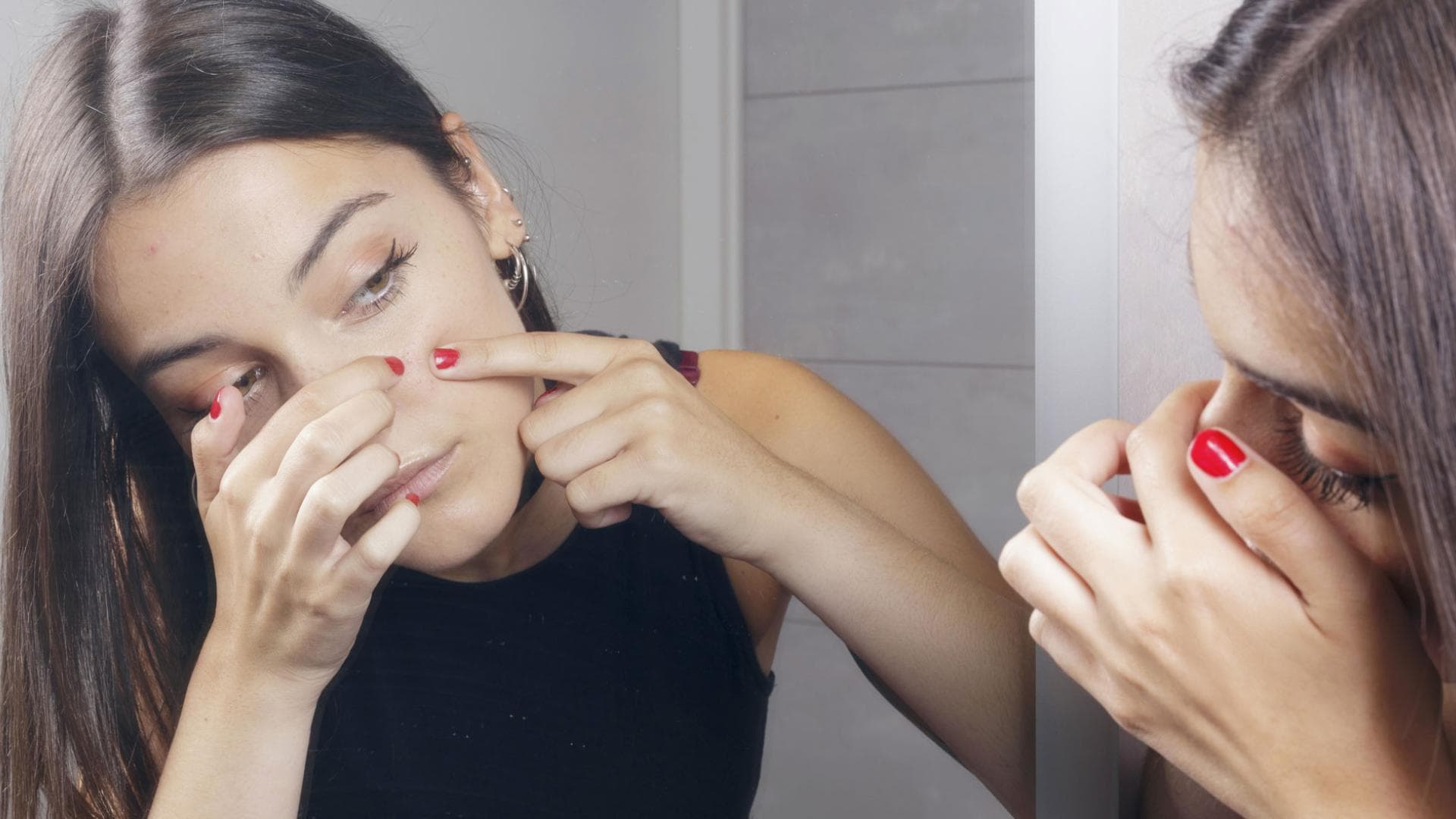 Periorale-dermatitis-quer