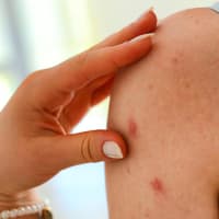 Skinpositivity-Aufmacher-quer Skinpositivity-Aufmacher-quer