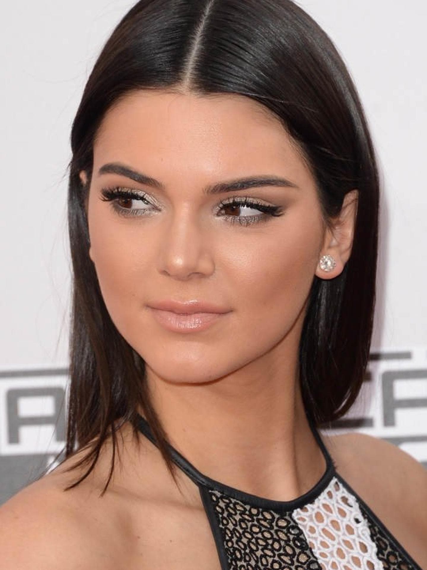 Kendall Jenner: Nasen-OP Kendall Jenner: Nasen-OP