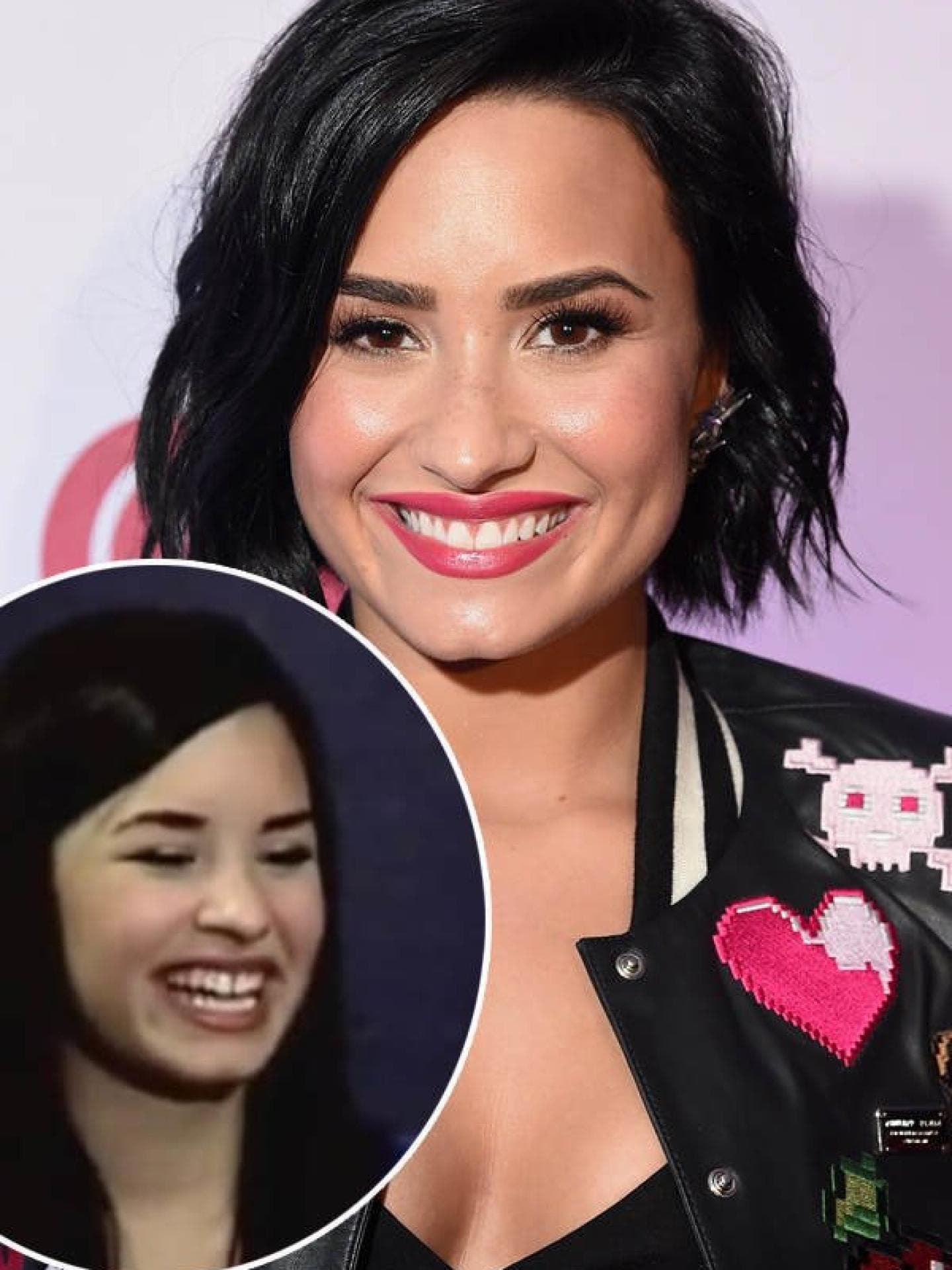 Zahnlücke: Demi Lovato bereut Schönheits-OP Zahnlücke: Demi Lovato bereut Schönheits-OP
