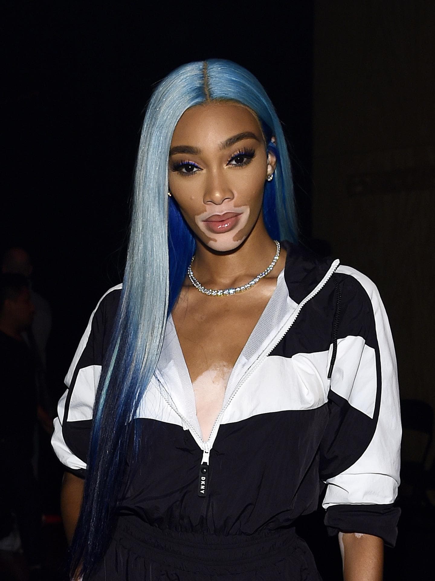 Winnie Harlow