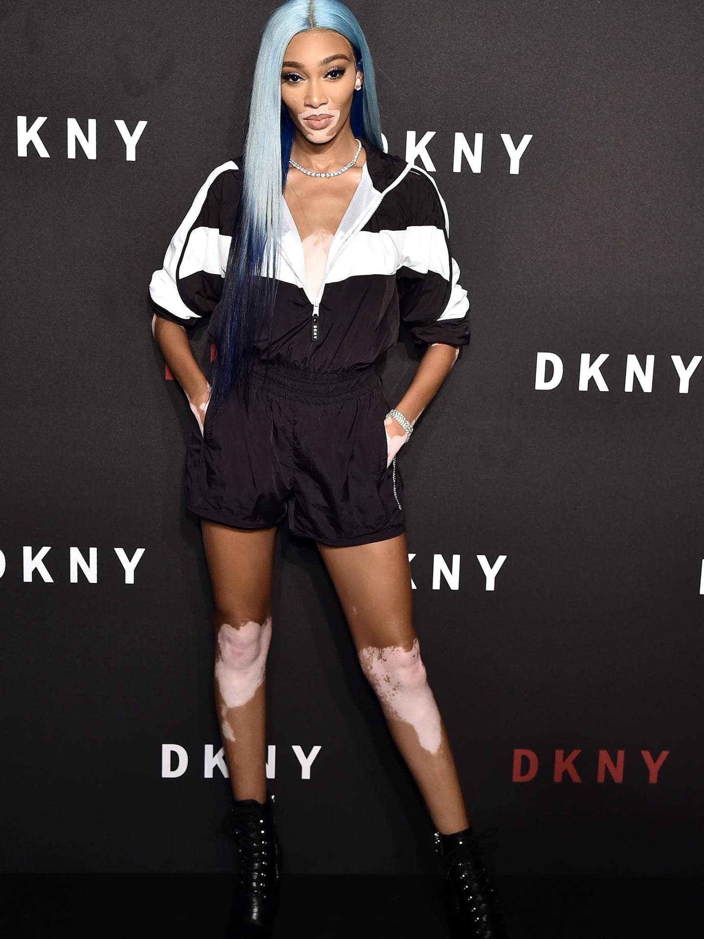 Winnie Harlow Outfit
