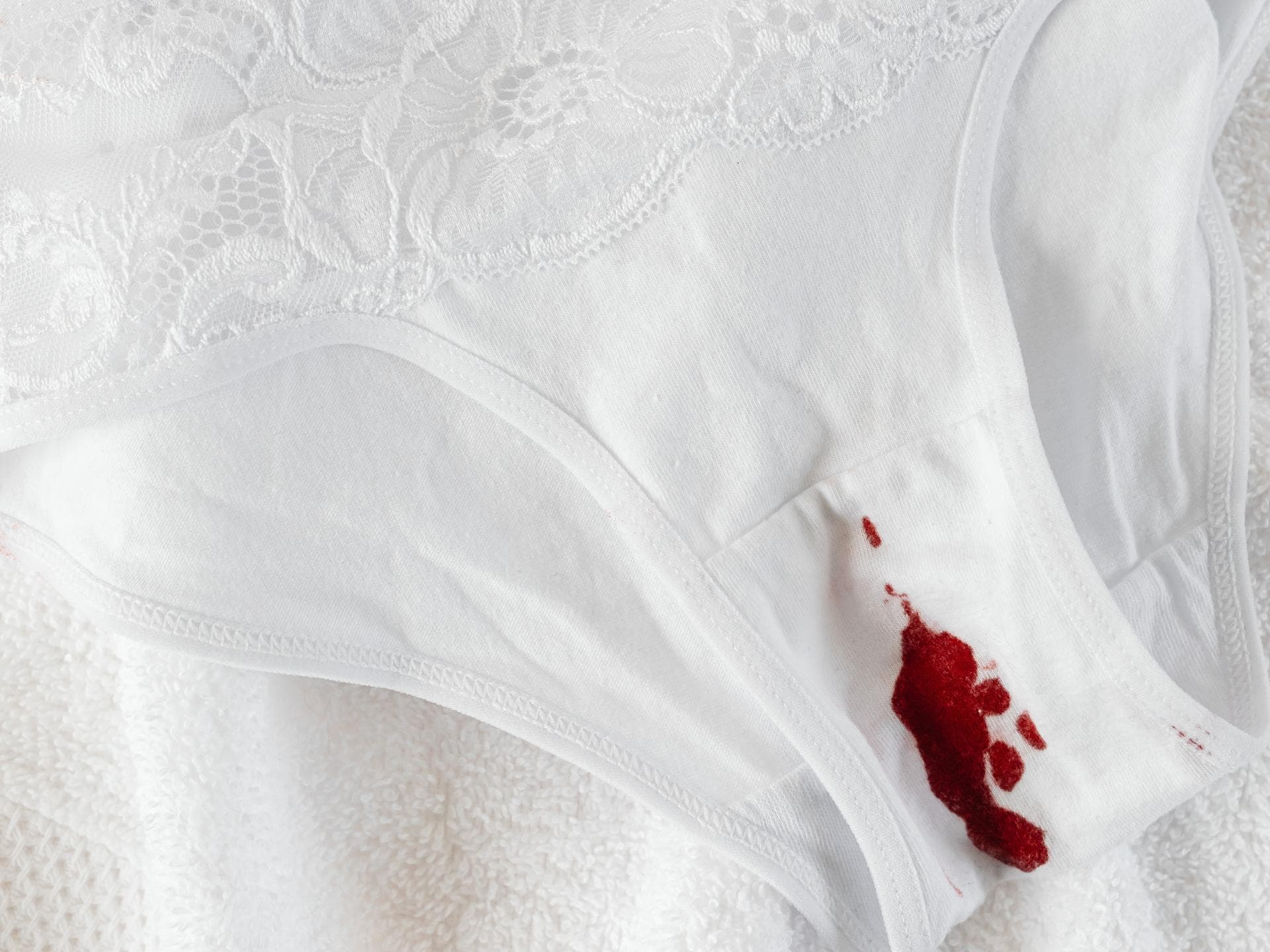 Zwischenblutung trotz Pille Unterhose mit Periodenblut