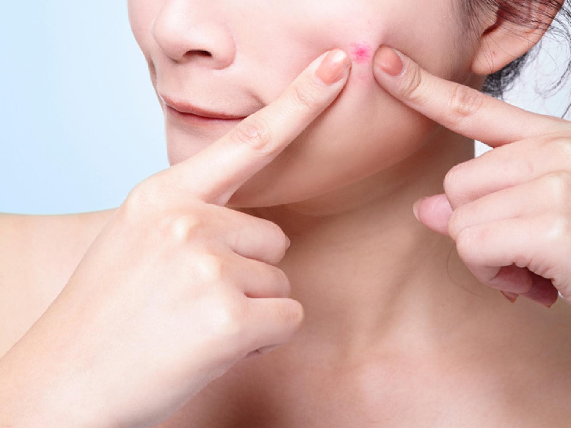 Schöne Haut und nie wieder Pickel?