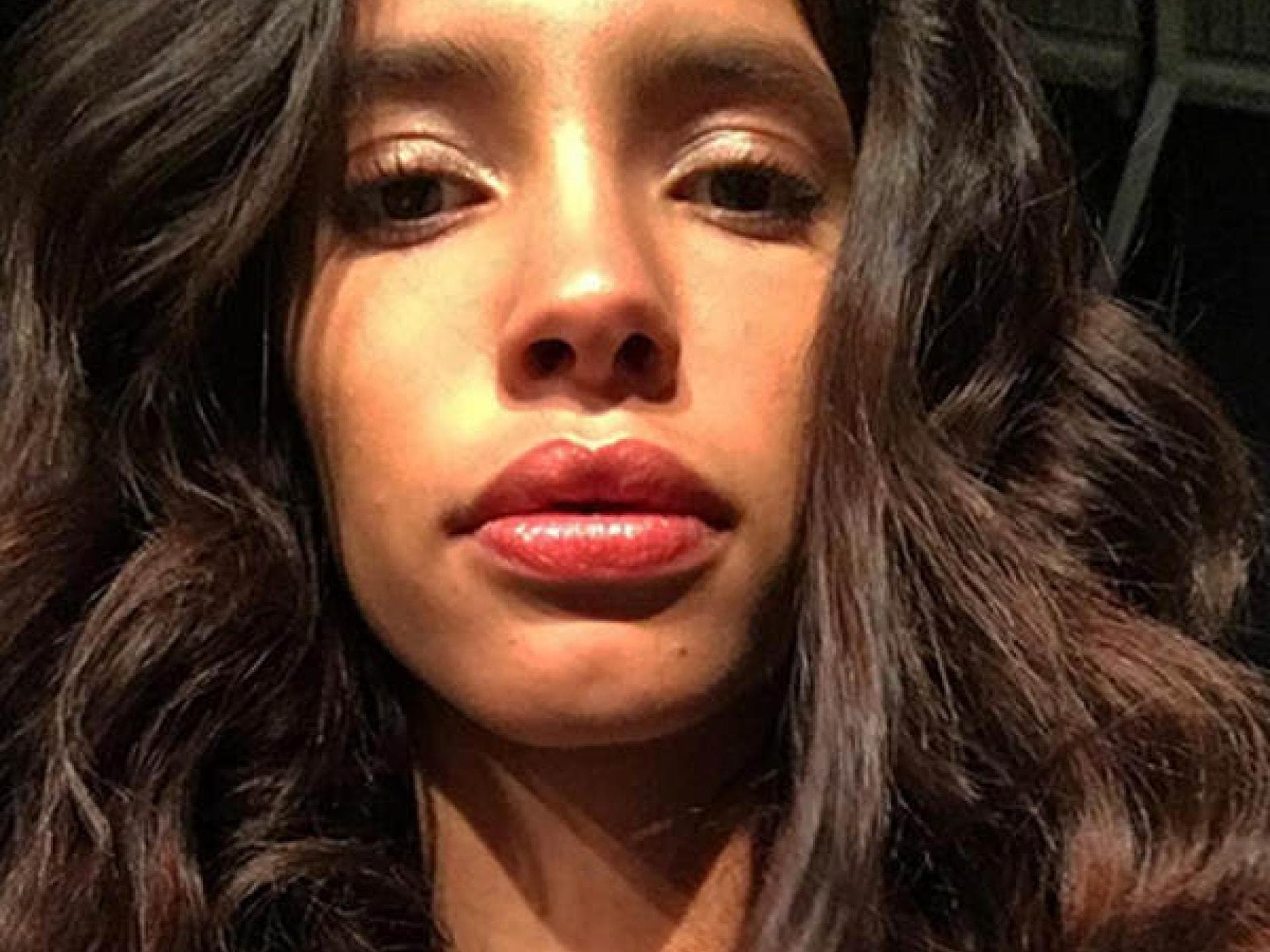 Lara von GNTM 2016: Schönheits-OP oder doch nicht?