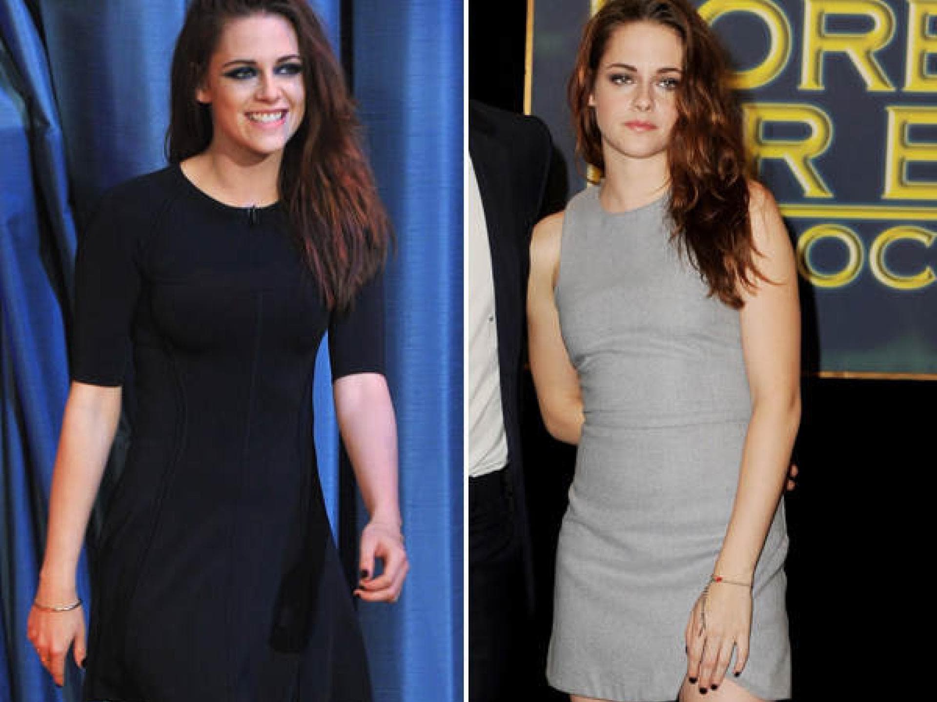 Kristen Stewart zeigt gern Bein