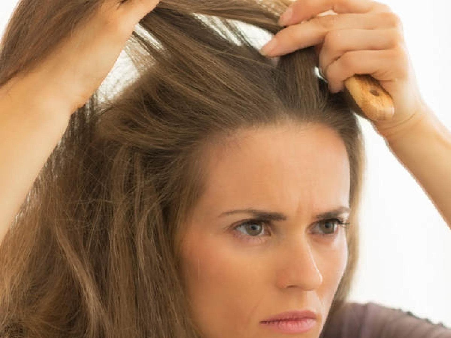 Wie kann ich meine Haare bei Schuppen stylen?