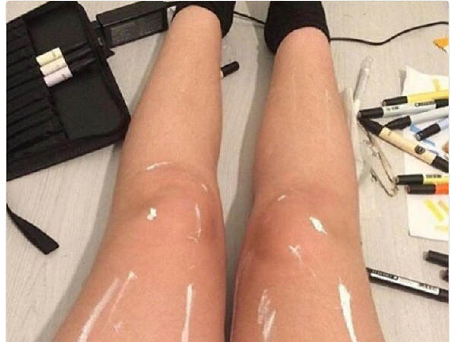 Diese Beine glänzen nicht