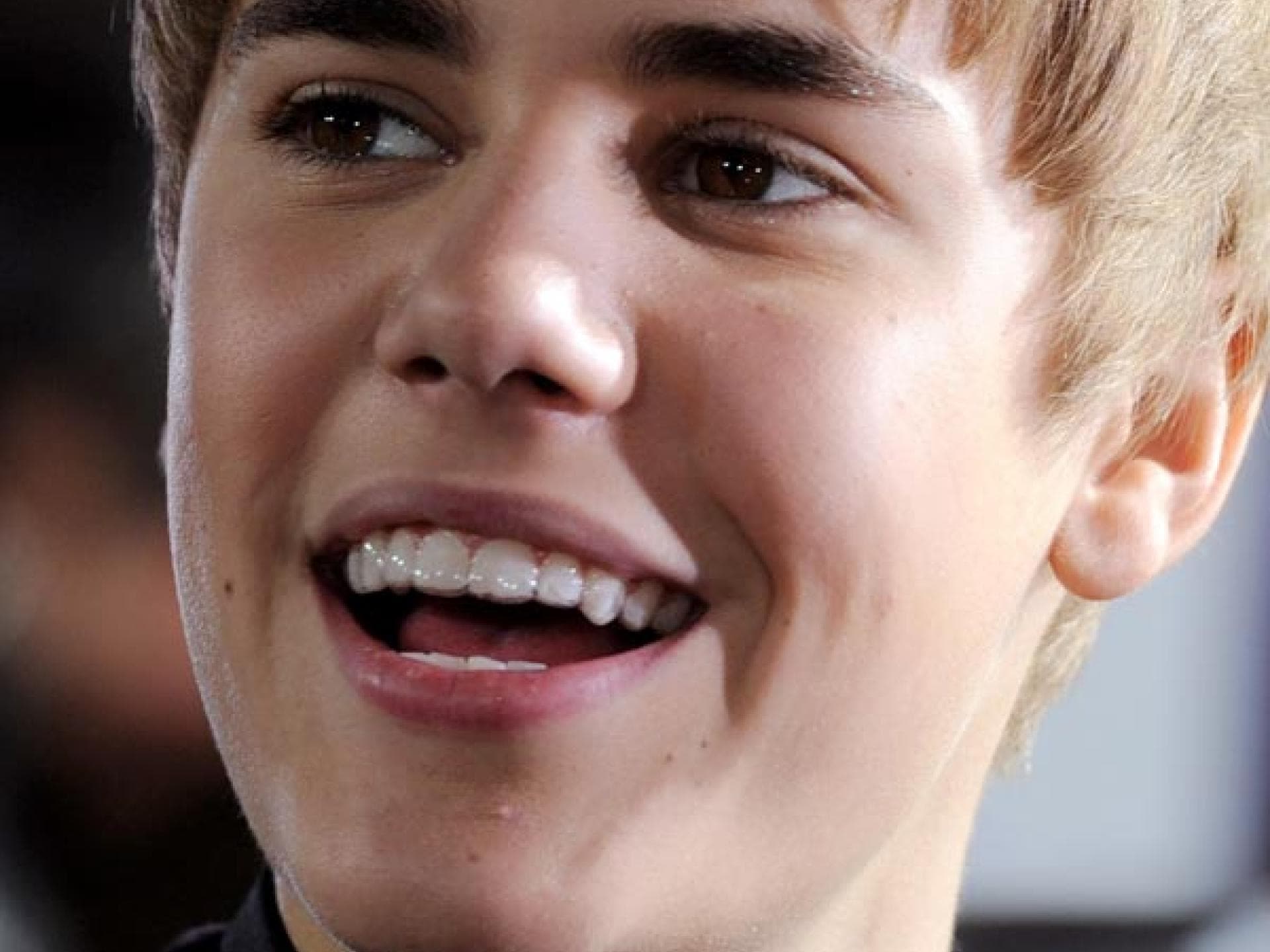 Justin Bieber hat eine Zahnspange