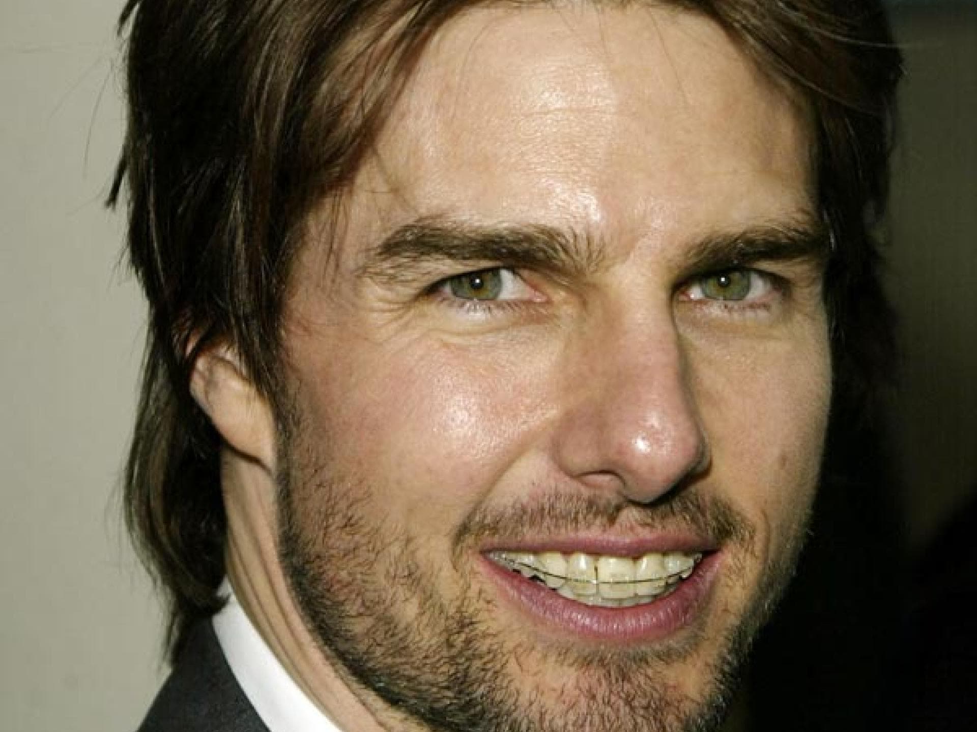 Tom Cruise mit fester Zahnspange