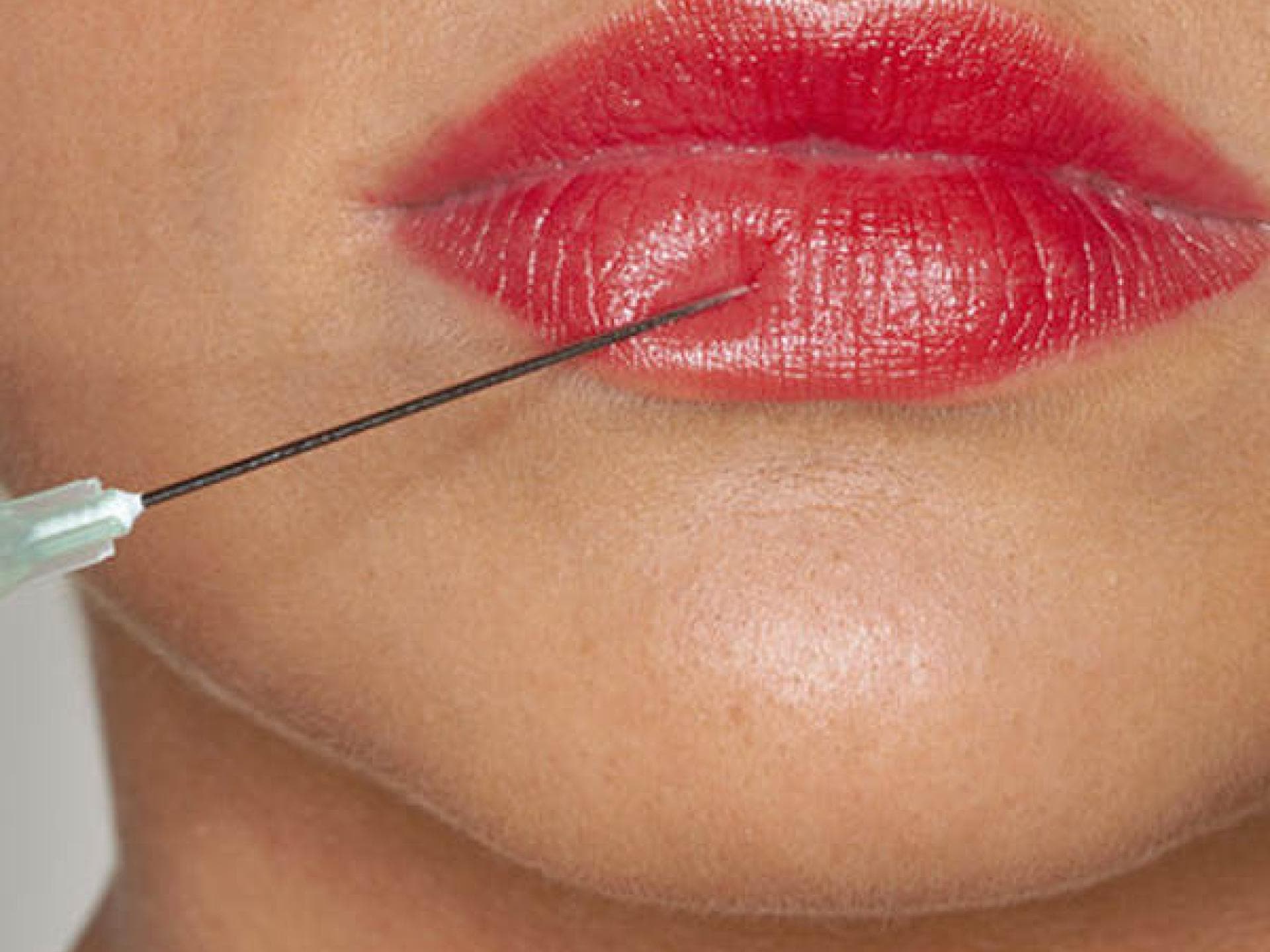 Ab welchem Alter darf sich ein Mädchen einer Schönheits-OP unterziehen?