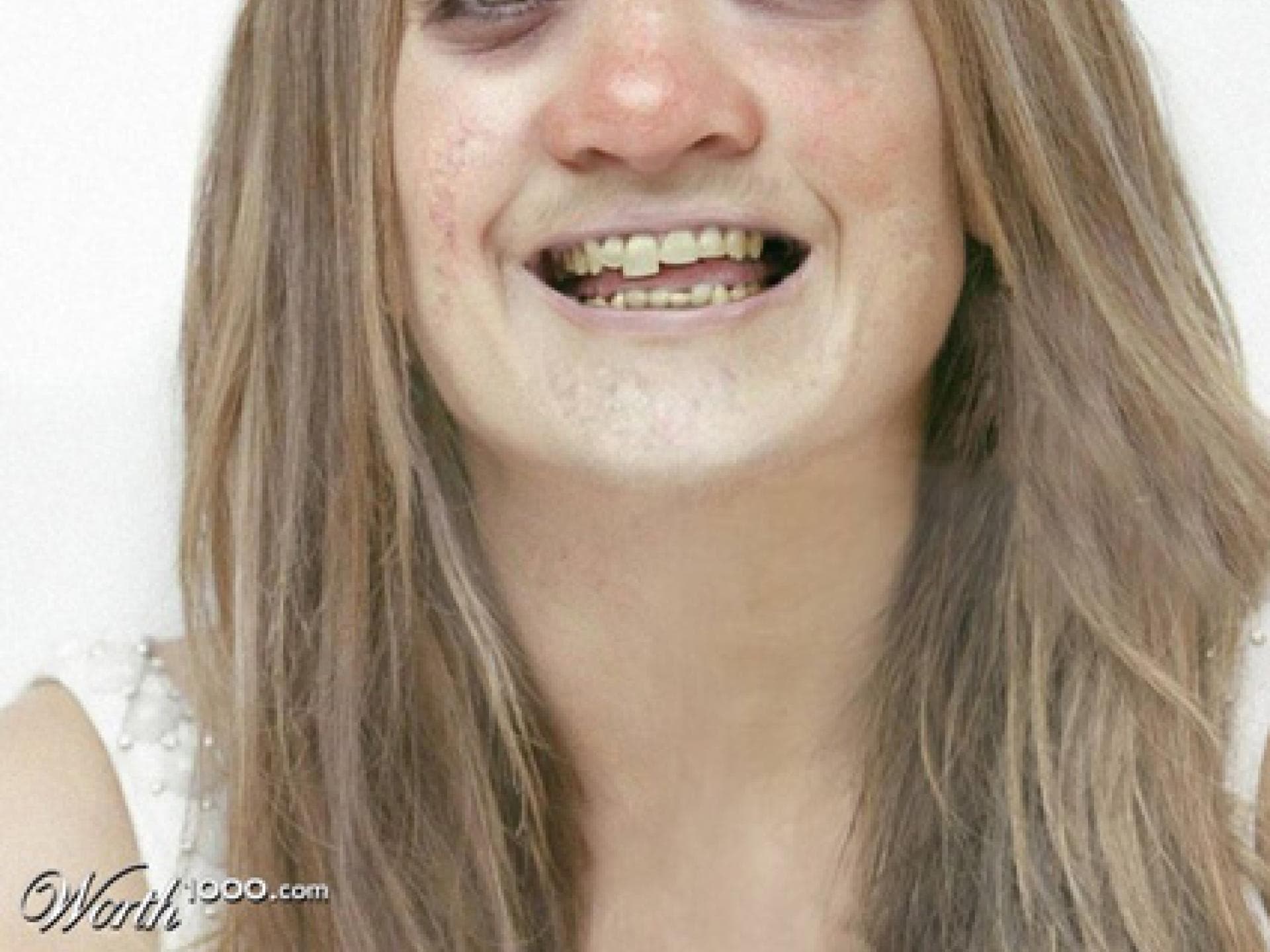 Jennifer Lopez mit Knollnase