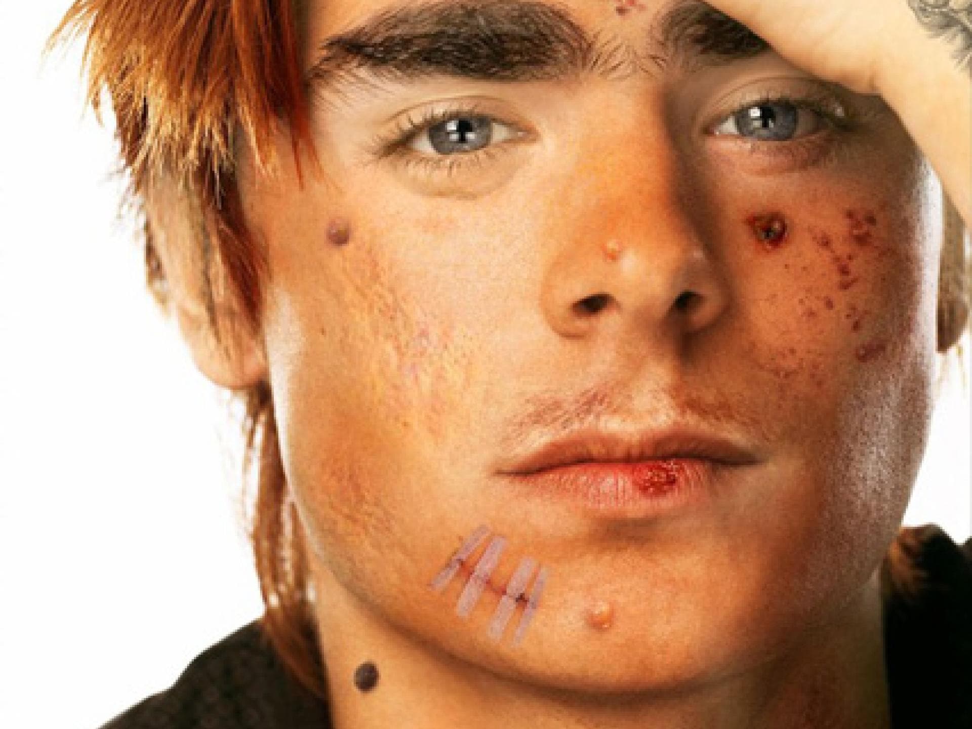 Zac Efron mit Narben