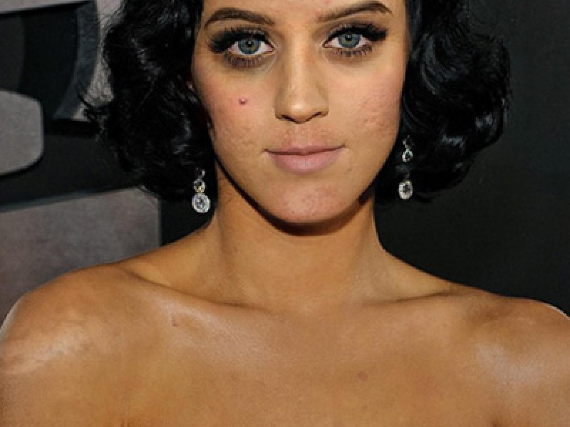 Katy Perry mit Pickeln