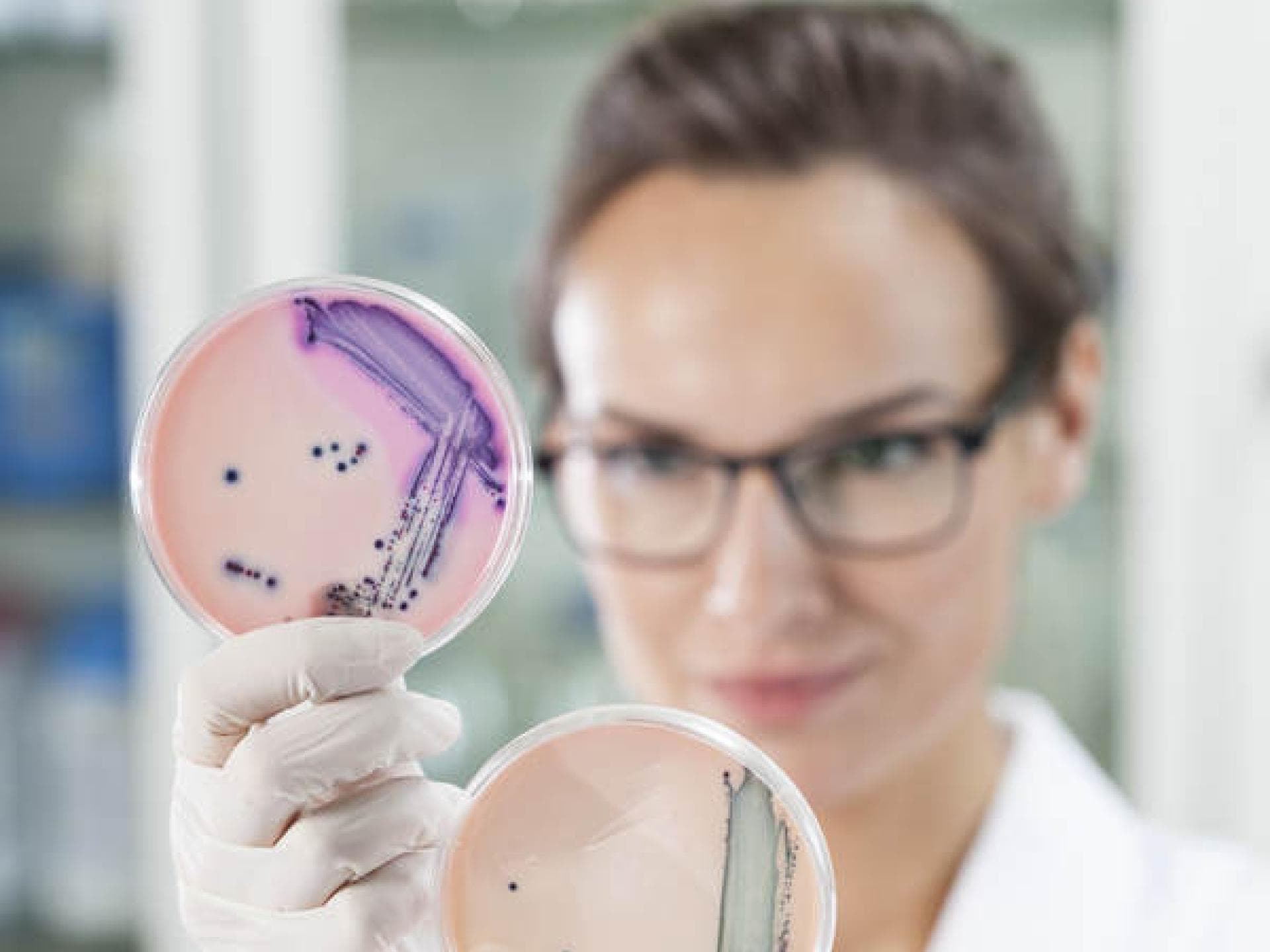 Wie entsteht ein Scheidenpilz?