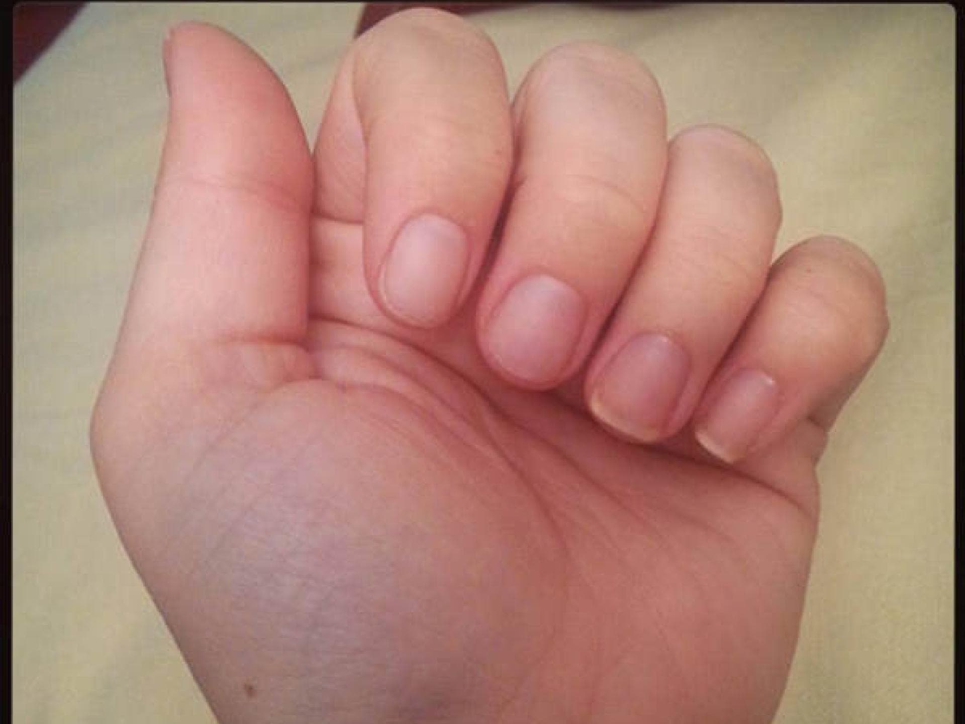 Kein Nagellack: Nackt