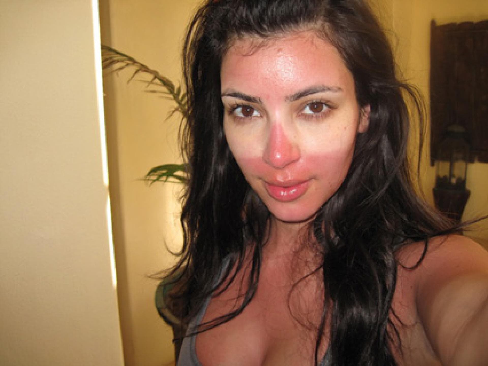Twitpic Kim Kardashian mit Sonnenbrand Twitpic Kim Kardashian mit Sonnenbrand