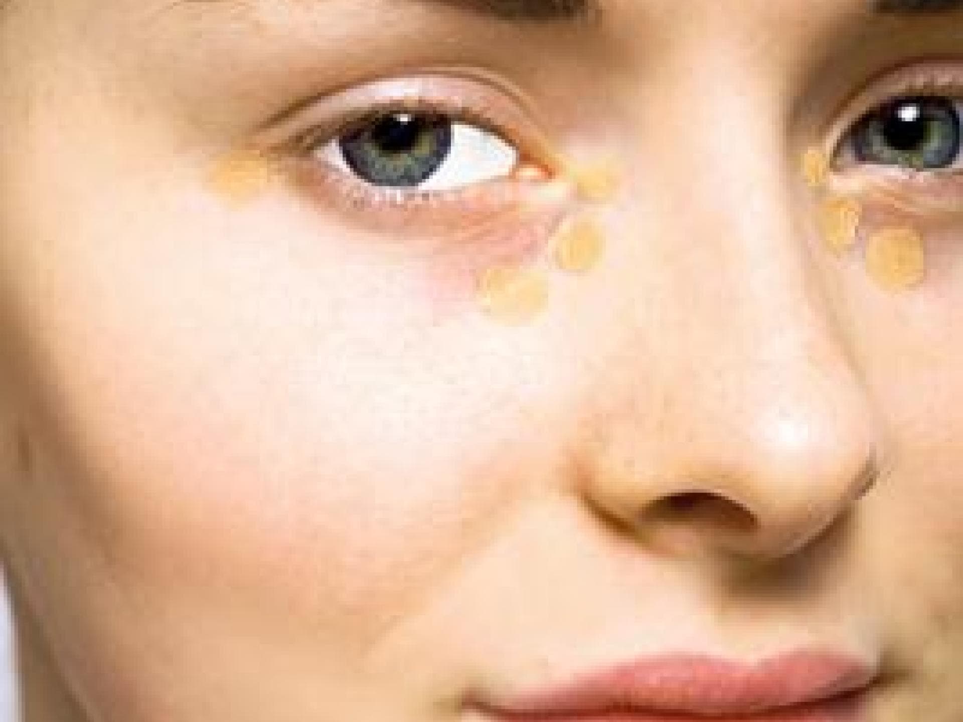 Augenschatten abdecken!