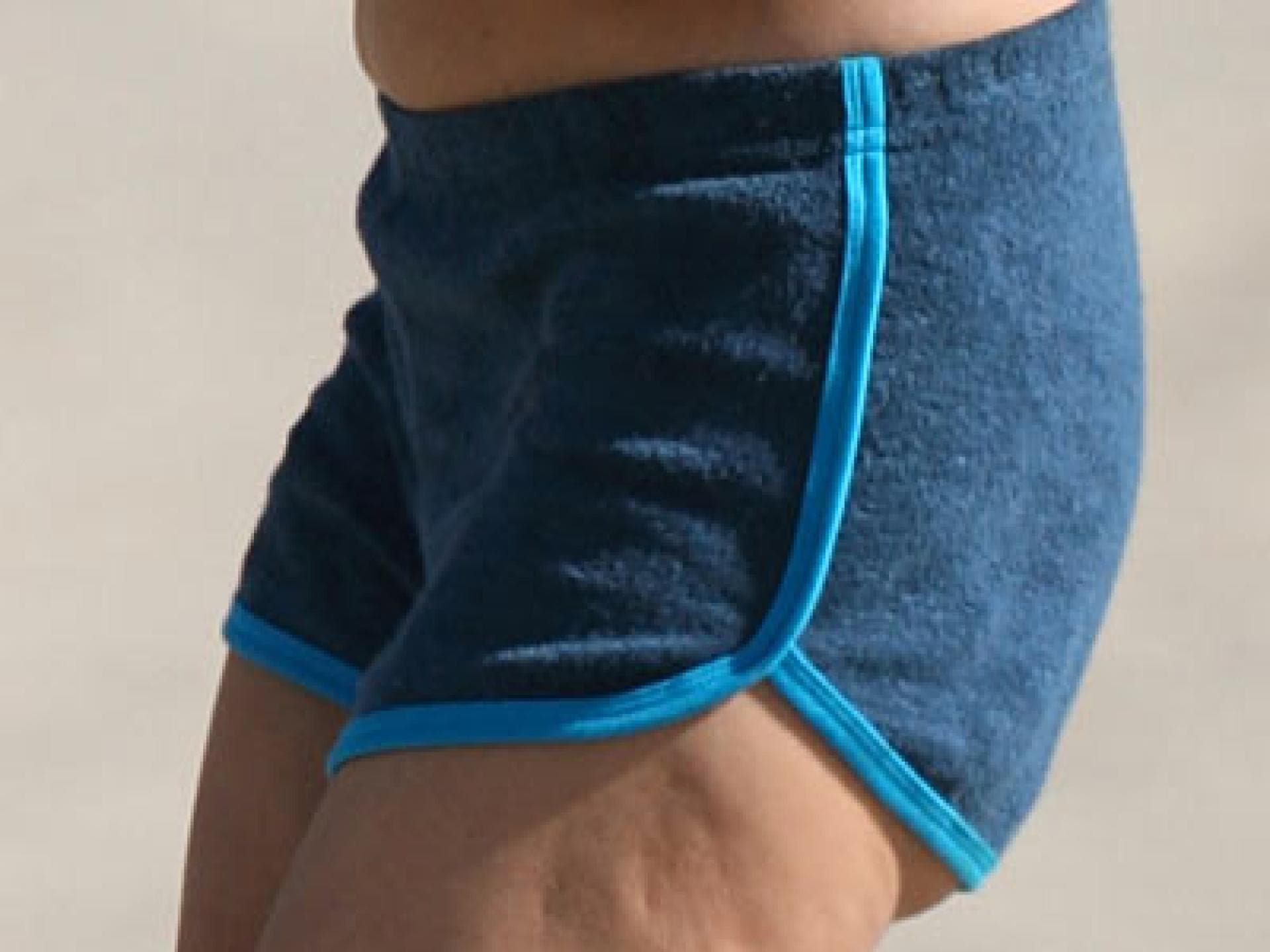 Paris Hilton hat Cellulite