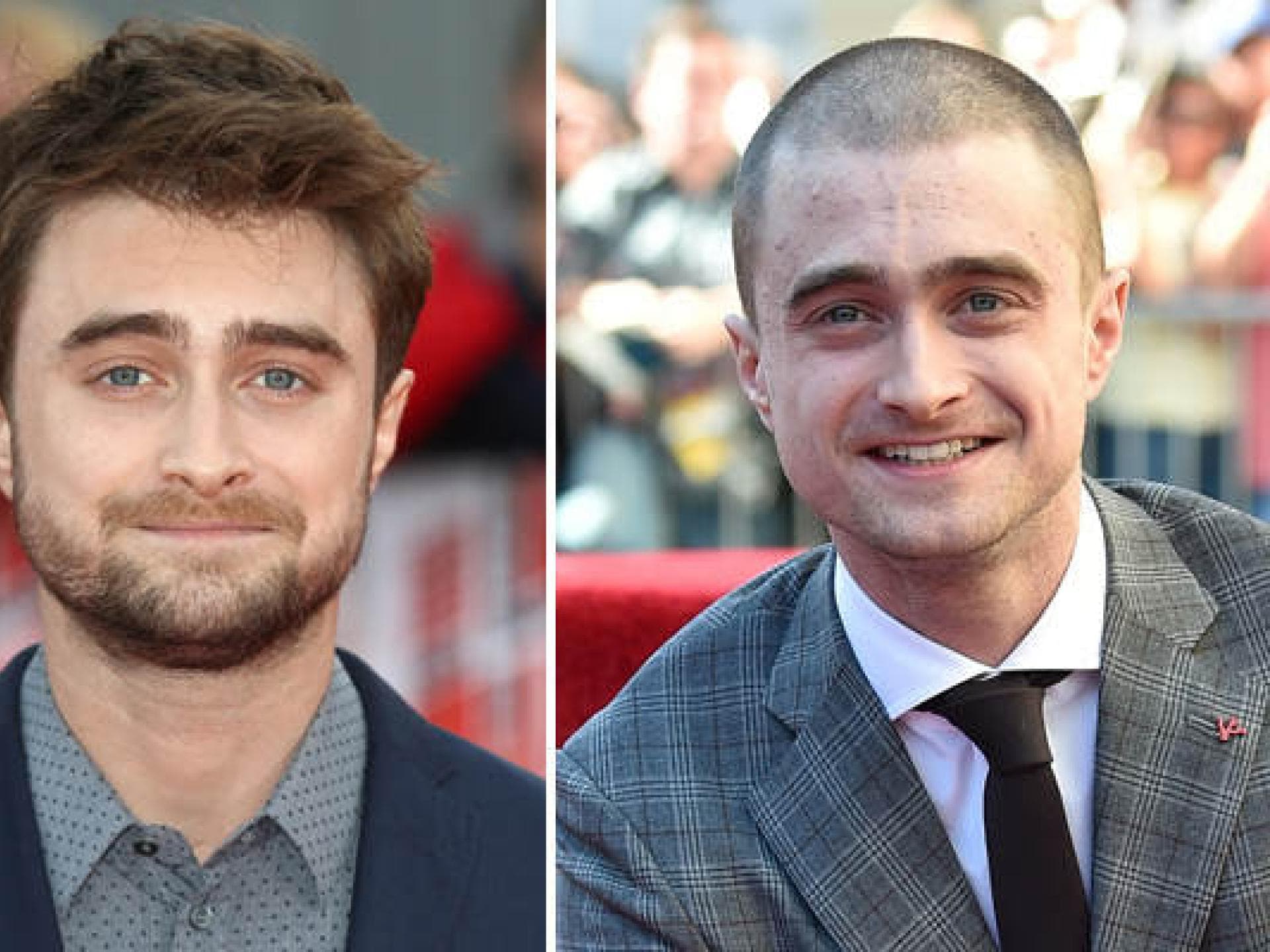 Daniel Radcliffe, aka Harry Potter mit Glatze Daniel Radcliffe, aka Harry Potter mit Glatze