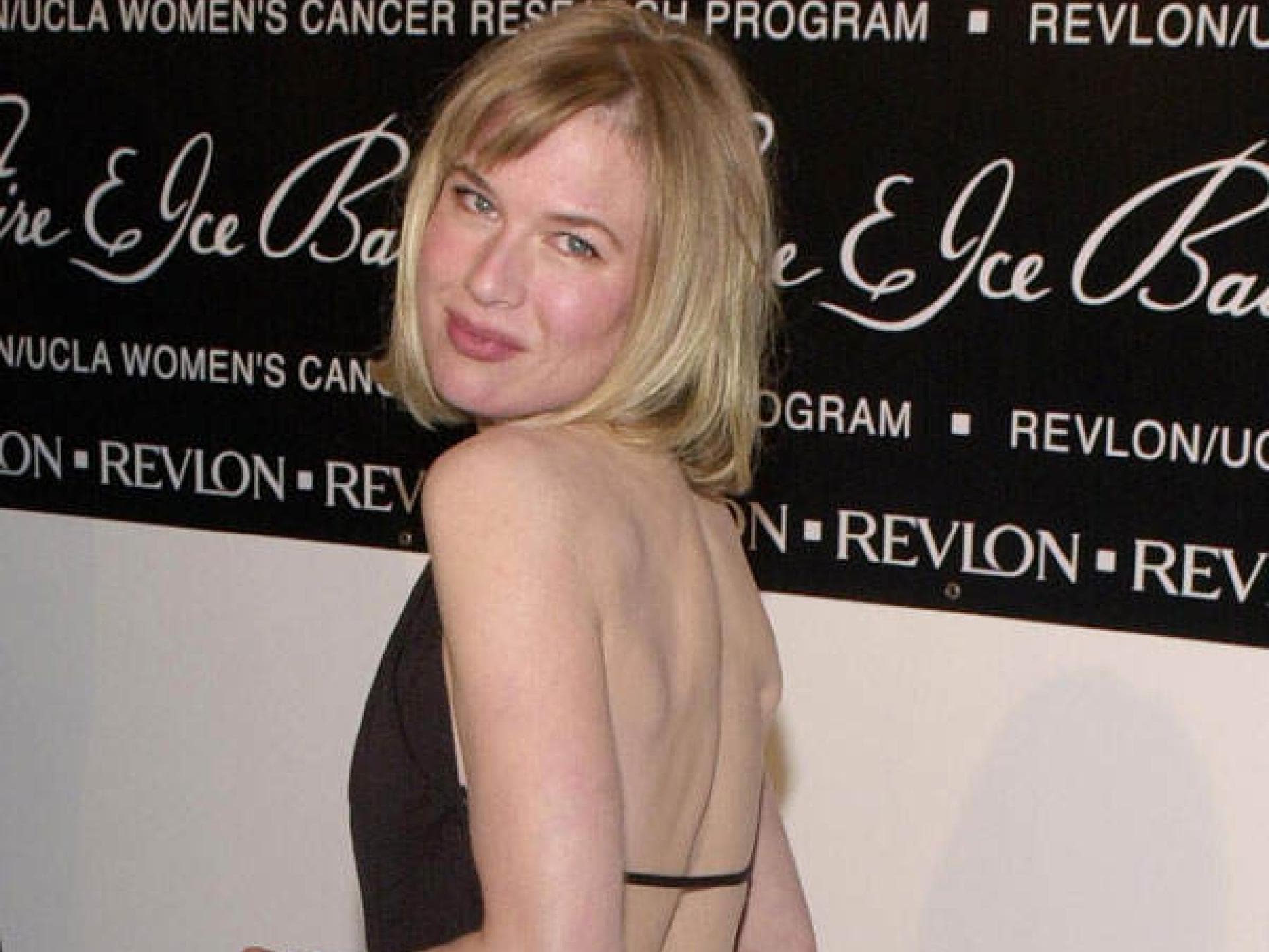 Renée Zellweger „Bridget Jones“: Vorher