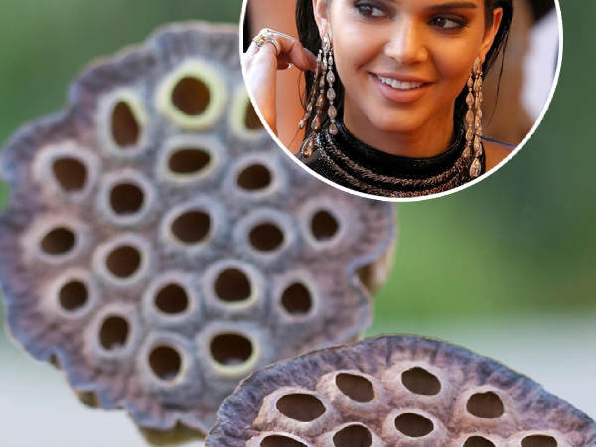 Kendall Jenner: Angst vor kleinen Löchern Kendall Jenner: Angst vor kleinen Löchern