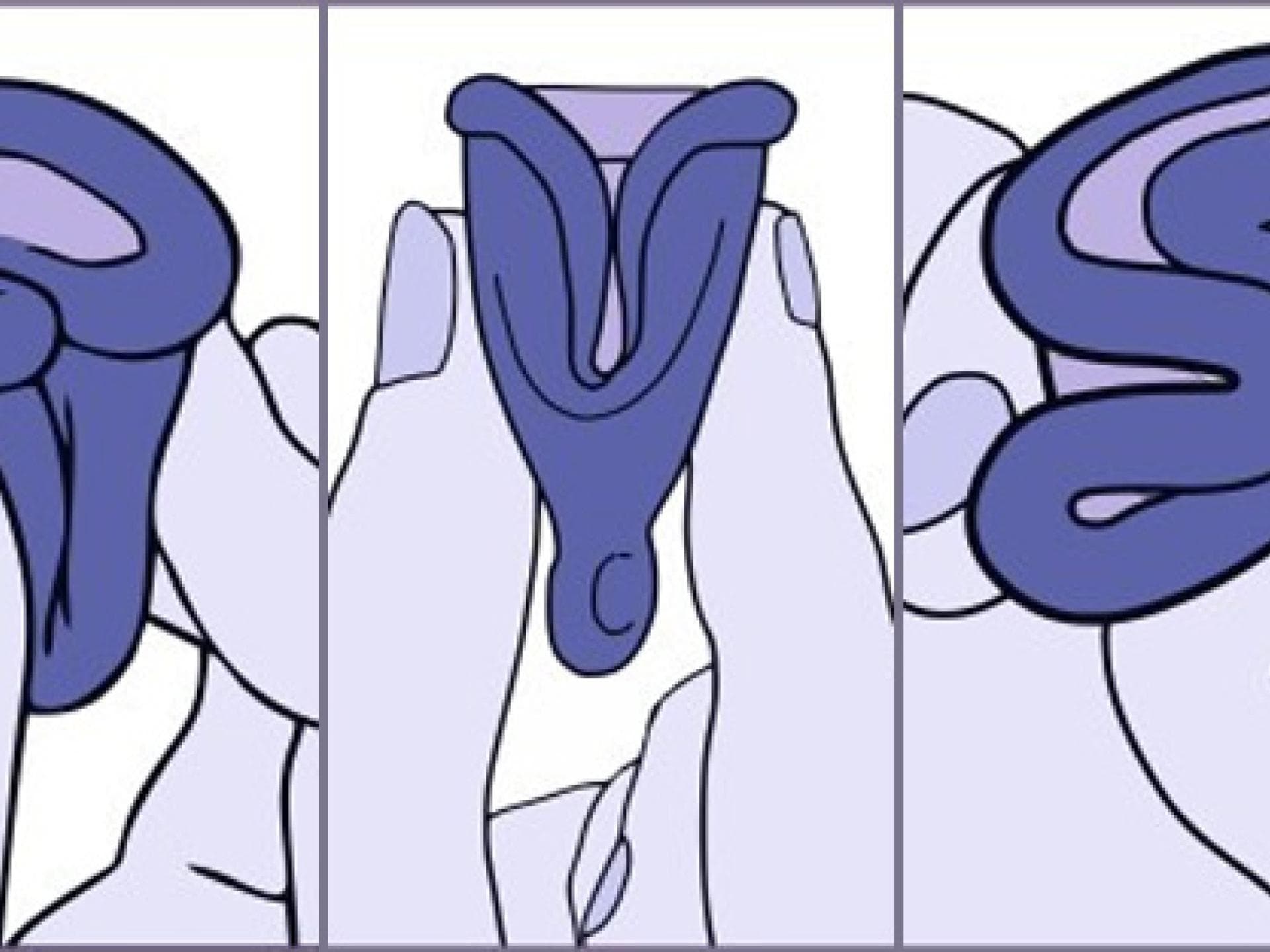 menstruationstasse-einfuehren-1916461.jpg