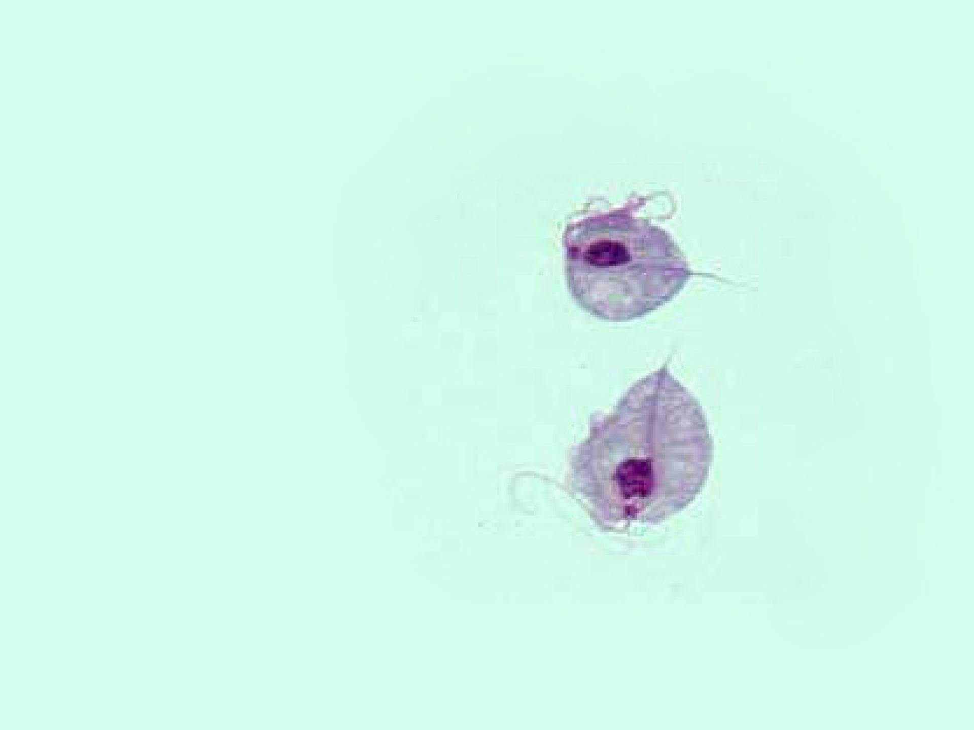geschlechtskrankheiten-trichomonadiasis-875384.jpg geschlechtskrankheiten-trichomonadiasis-875384.jpg