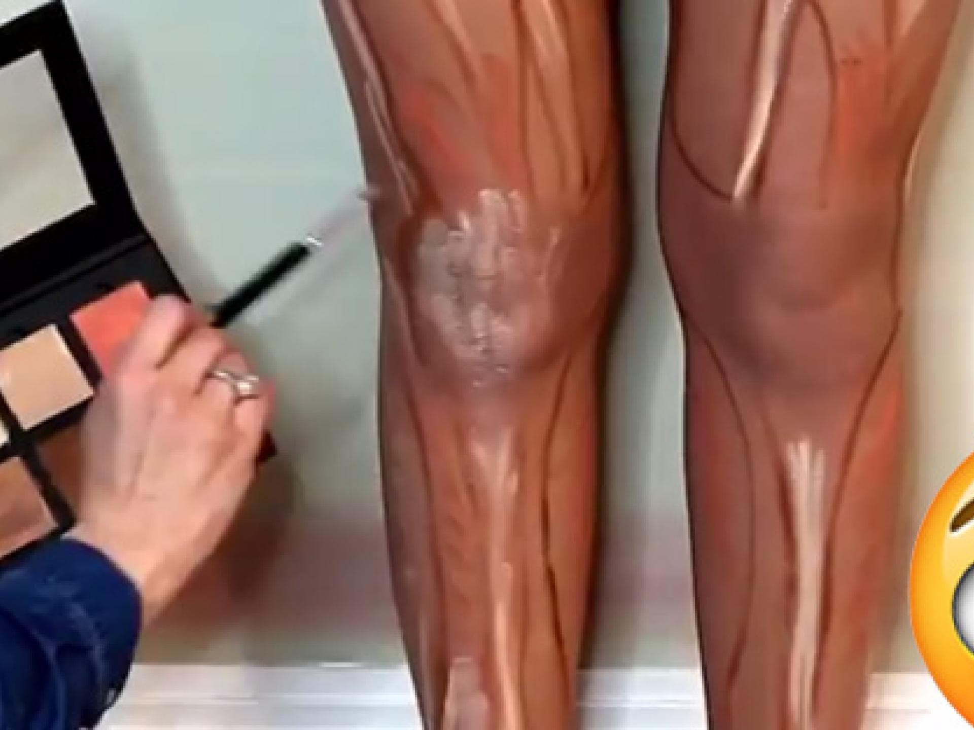 leg-contouring-557-2104682.jpg
