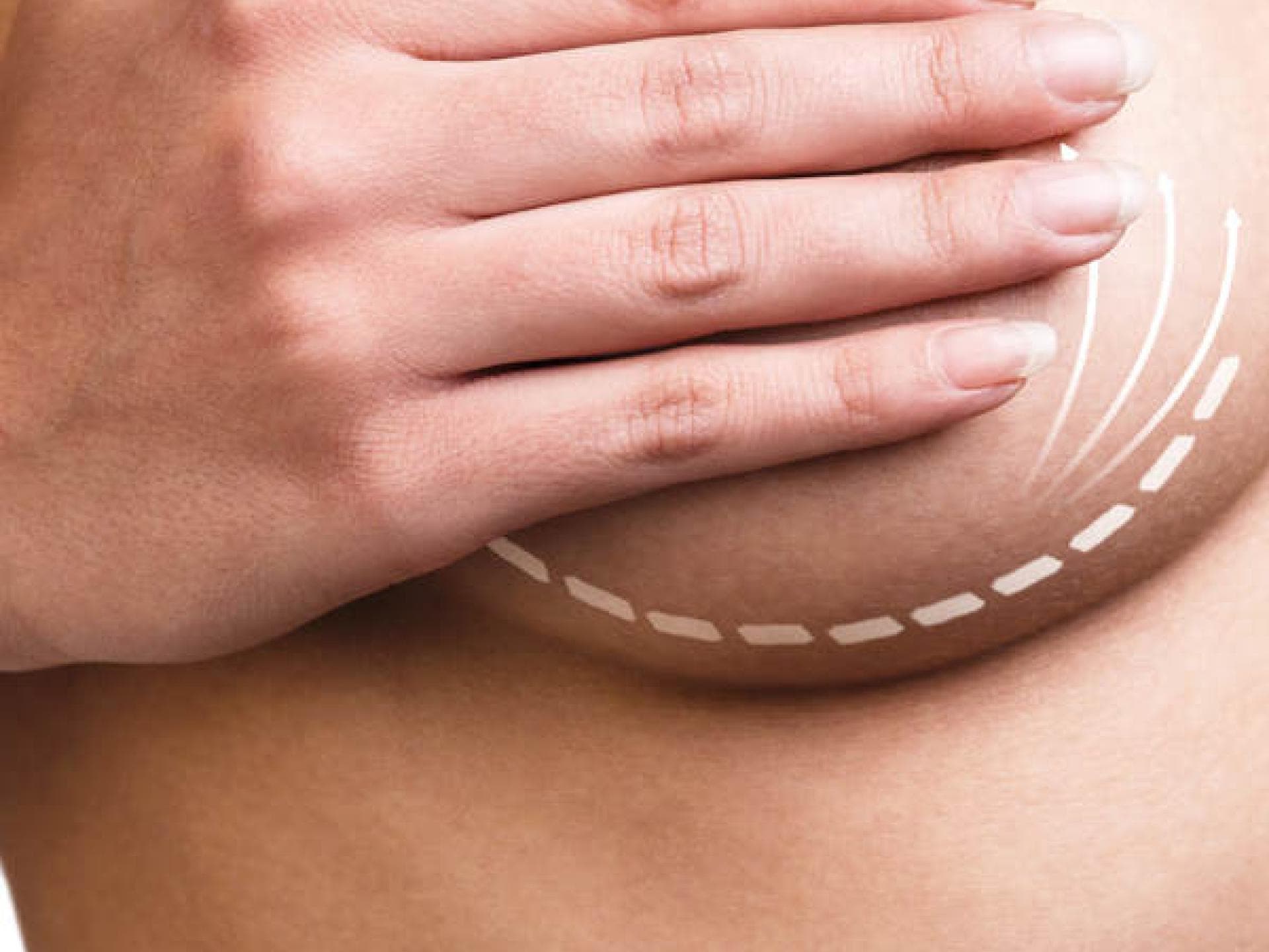 Was sind die häufigsten „Problemzonen“ der Mädchen?