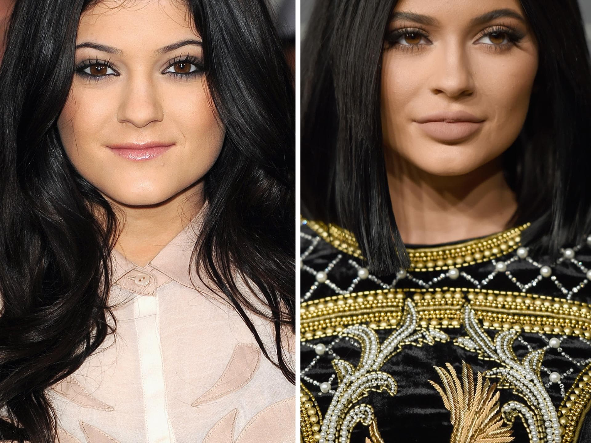 Kylie Jenner Lippen aufspritzen inline Kylie Jenner Lippen aufspritzen inline