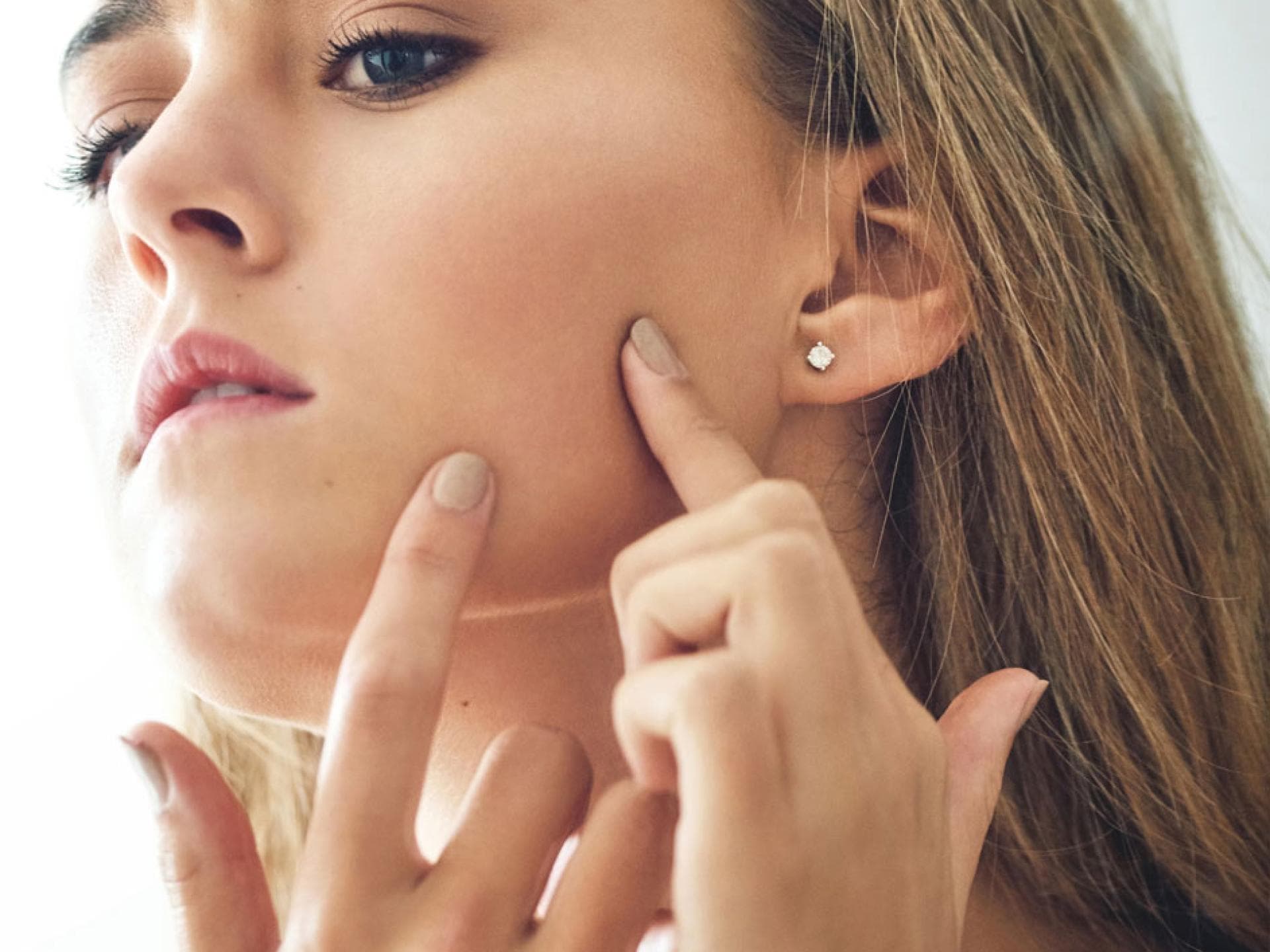 Tipps gegen unreine Haut: Pickel ausdrücken?