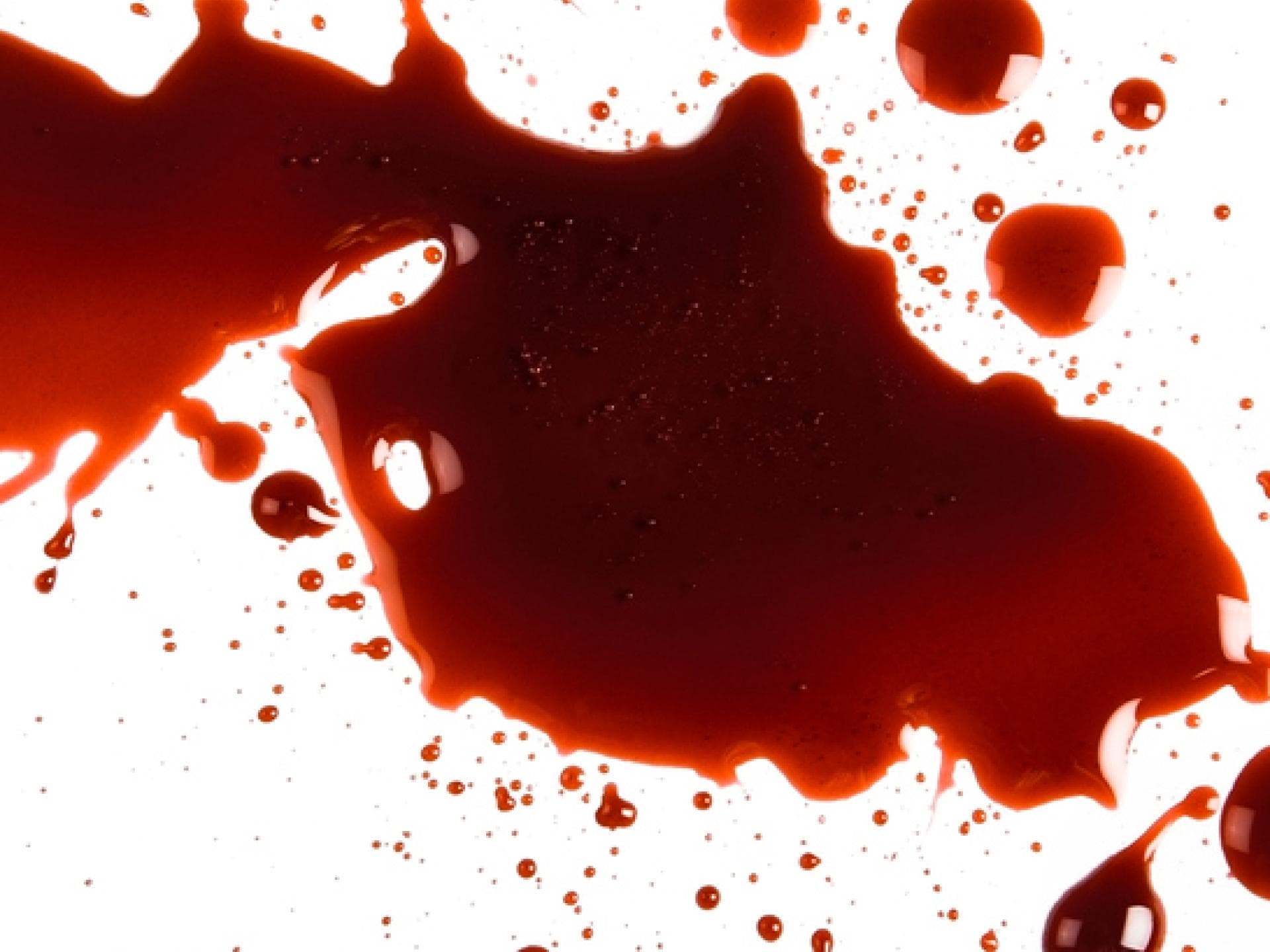 Periodenblut aus der Unterhose entfernen