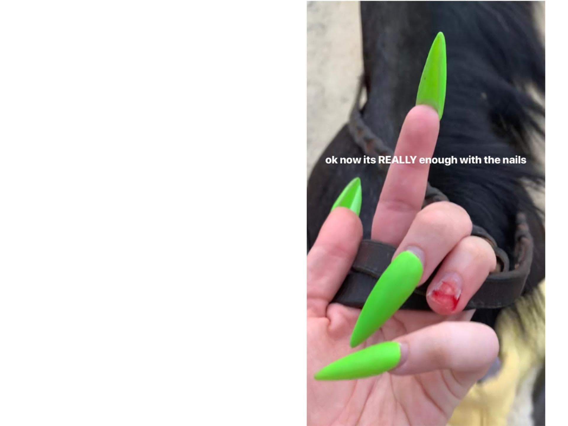 billie-eilish-fingernagel-story billie-eilish-fingernagel-story