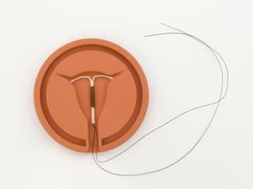 Sport nach Spirale einsetzen