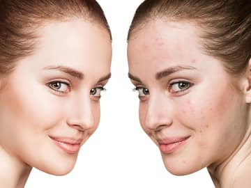 Make up unreine Haut quer