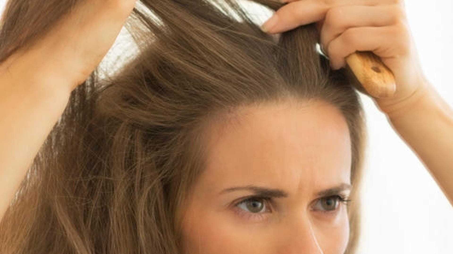 Wie kann ich meine Haare bei Schuppen stylen?
