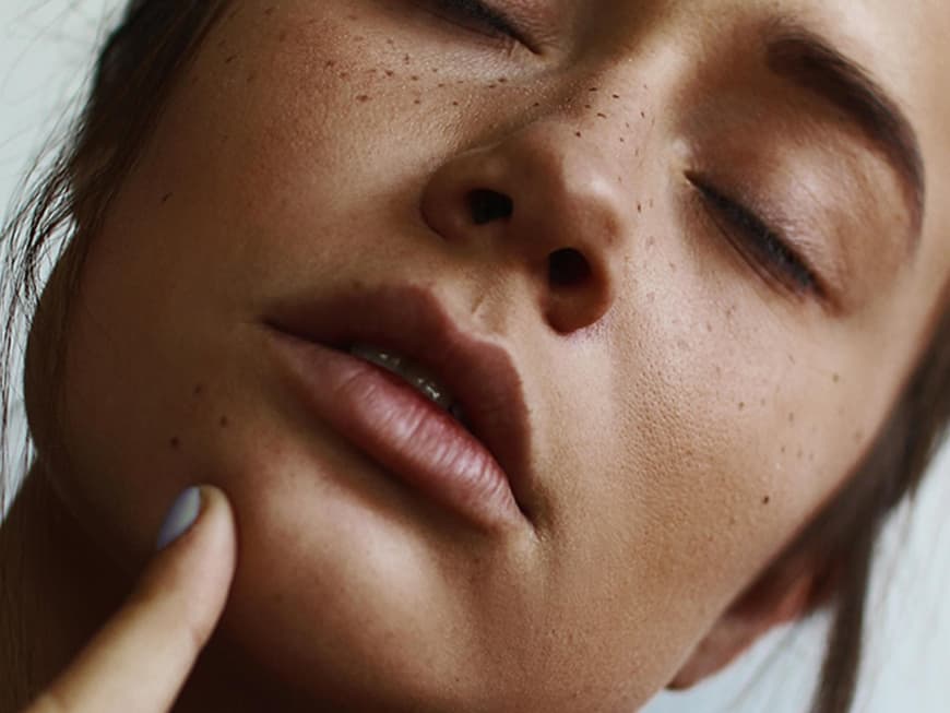 Pickel am Kinn So bekämpfst du sie!